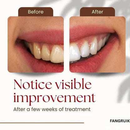 Probiotic Whitening Toothpaste (BUY 1 GET 1 FREE)