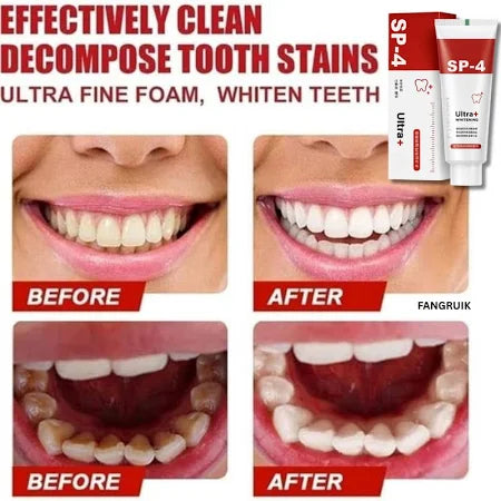 Probiotic Whitening Toothpaste (BUY 1 GET 1 FREE)